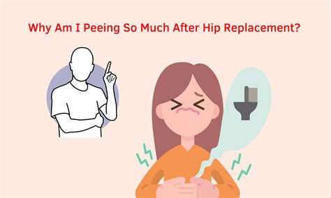 URINARY-bladder and voiding problems after total joint replacement and other surgical procedures are a potential cause of increased morbidity. . Why am i peeing so much after hip surgery